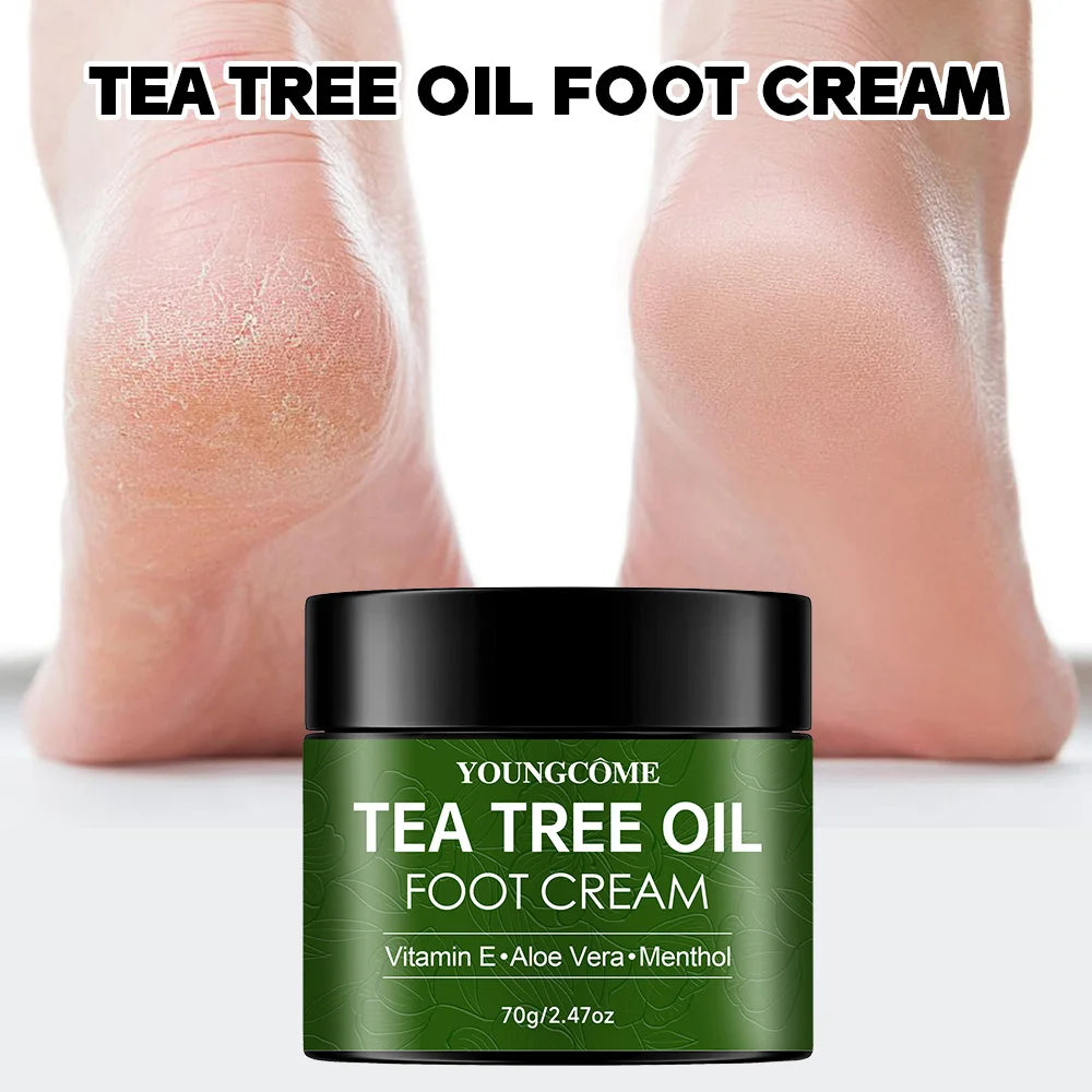 Foot Cream For Cracked heels