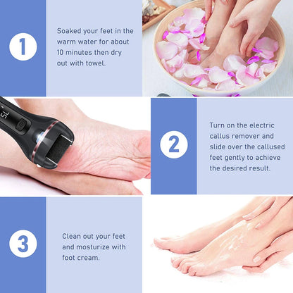 Alurette Electric Foot File